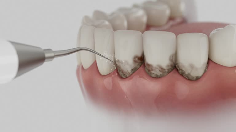 Reliable Dental Implants contractor in Fairmont, IL by Smile Center Dentistry
